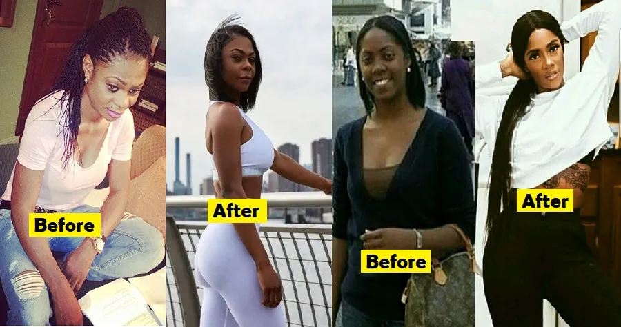 See Alleged Photos Of Nigerian Celebrities Before And After Plastic Surgeries