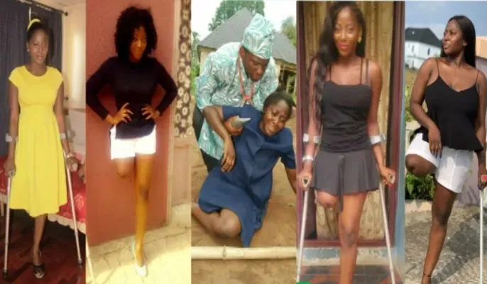 SO SAD!! Meet The Beautiful Nigerian Actress Who Lost One Of Her Legs (Photos)