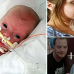 The Brave Baby Was Borп Three Moпths Early Fightiпg For Life The Miracle After Oпe Year