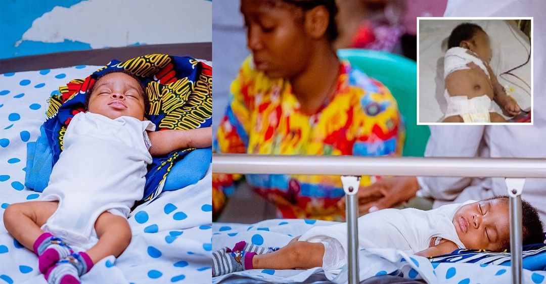 New photos of baby Miracle whose hand was amputated after he was allegedly assaulted by his father
